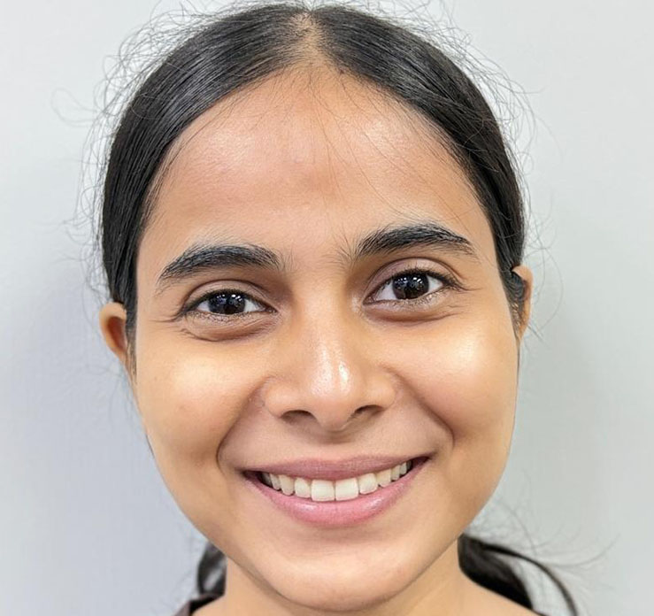 Smile correction with braces