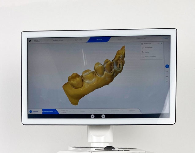 Intraoral scanning