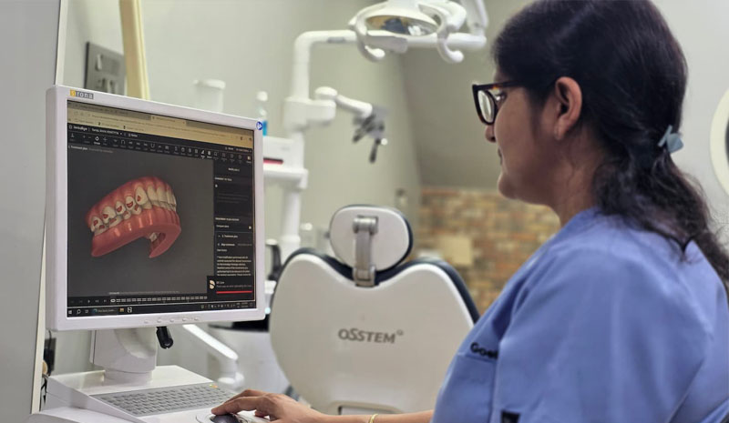 Detailed planning for smile correction