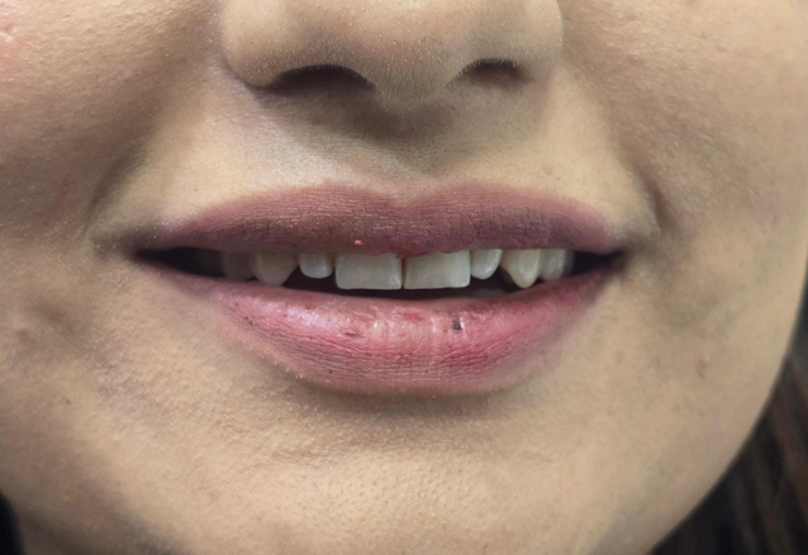 Person with imperfect teeth